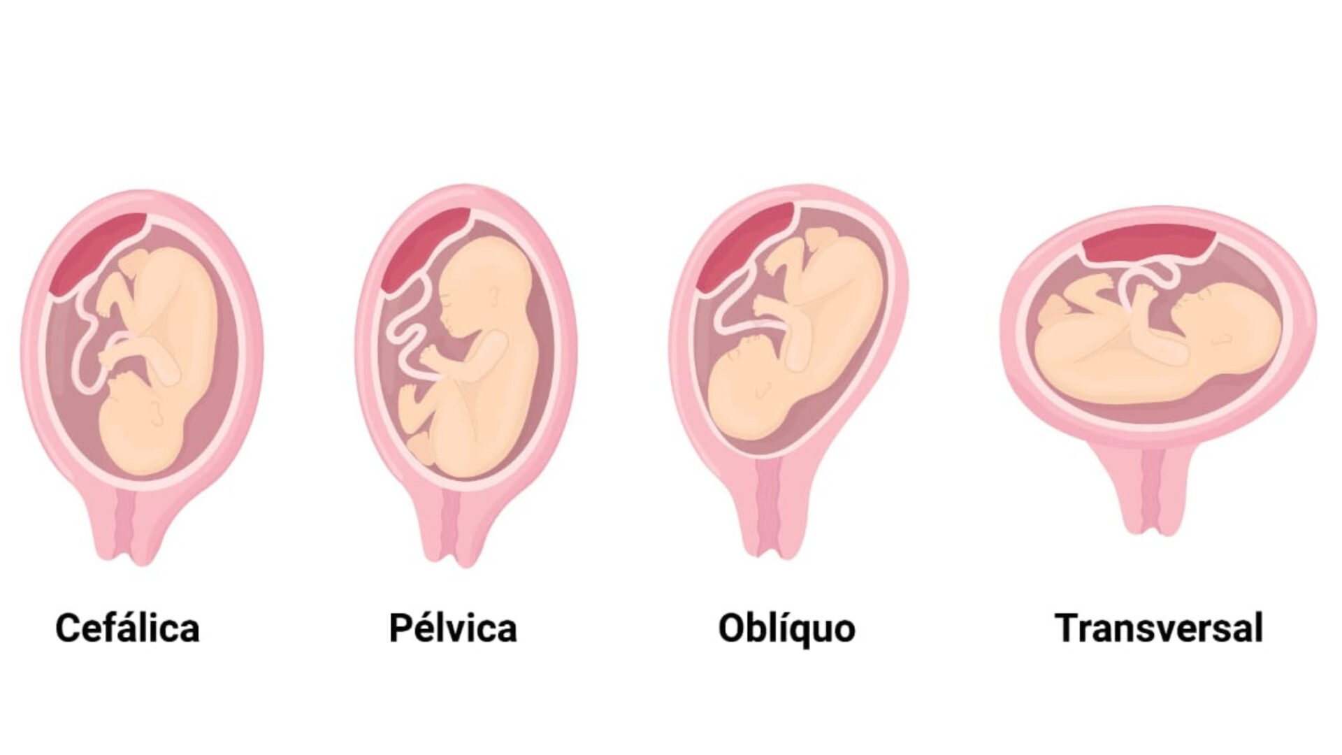 Posições Fetais