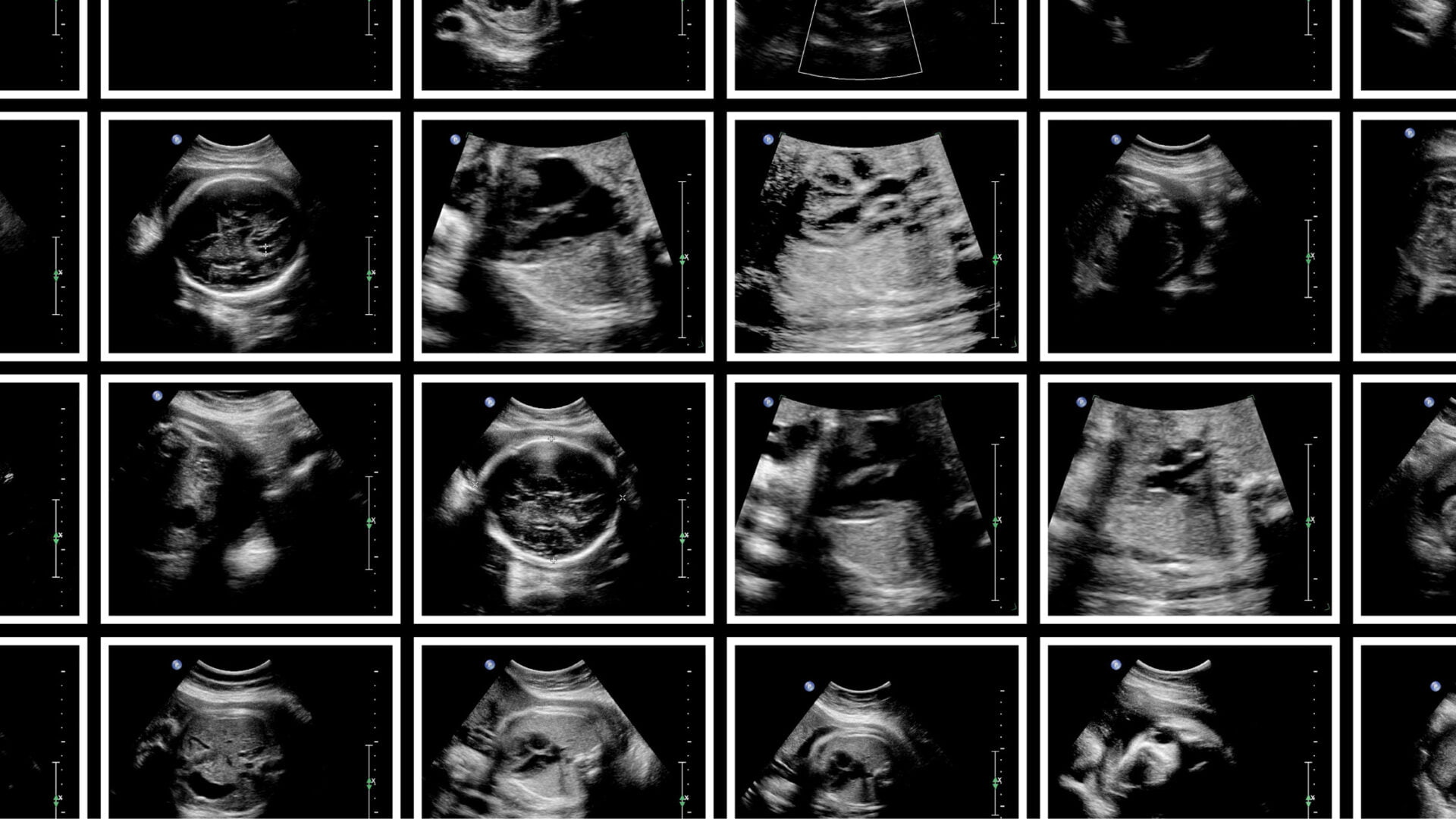 Desenvolvimento Fetal: O Que Esperar a Cada Trimestre