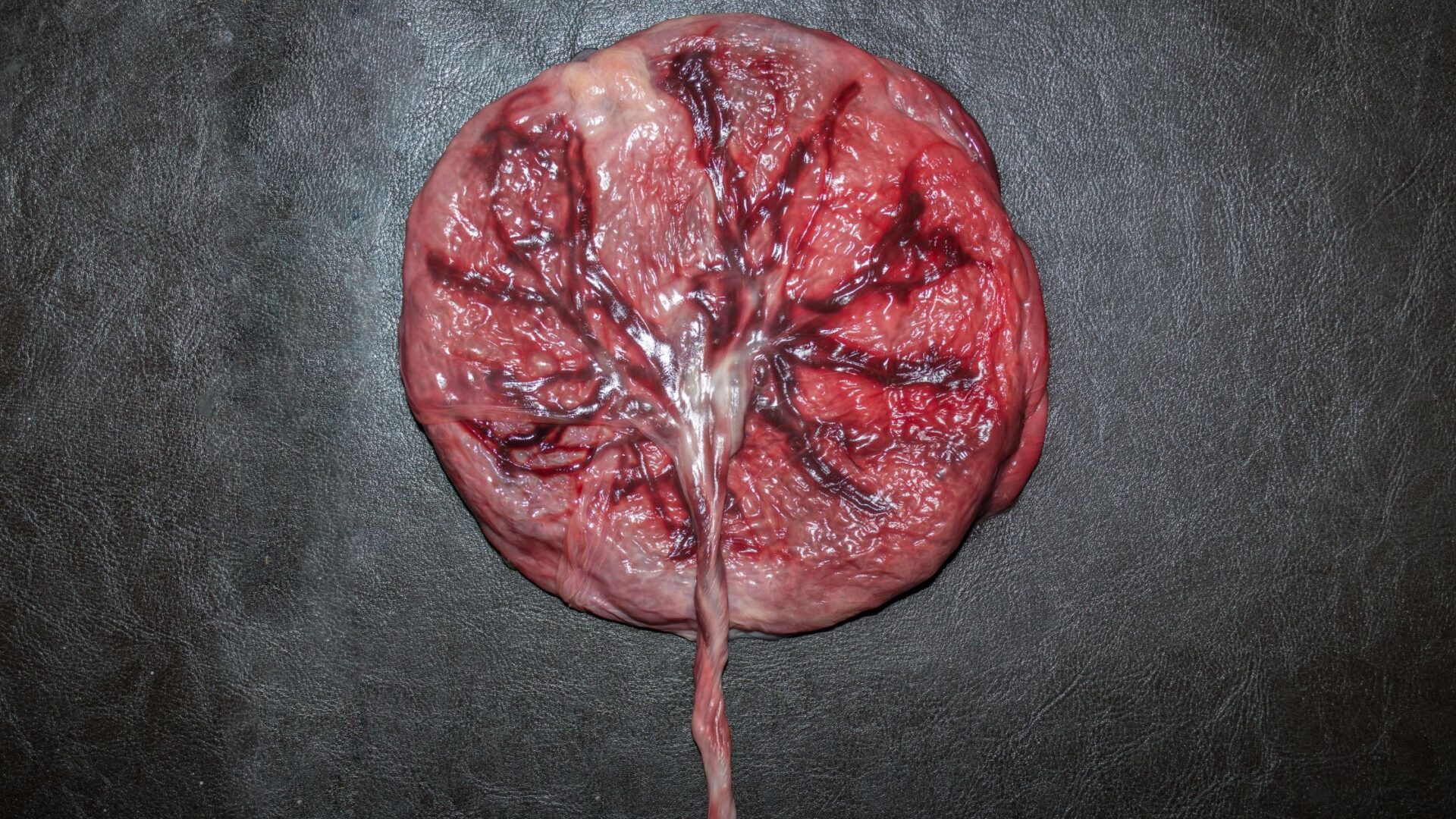 O Papel Vital da Placenta Durante a Gravidez: Conhecendo sua Importância e Funções