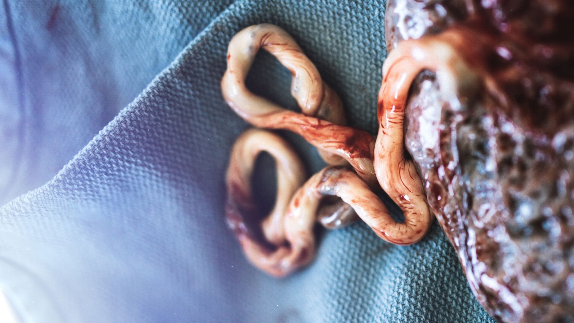 O Cordão Umbilical: Funções, Cuidados e Curiosidades