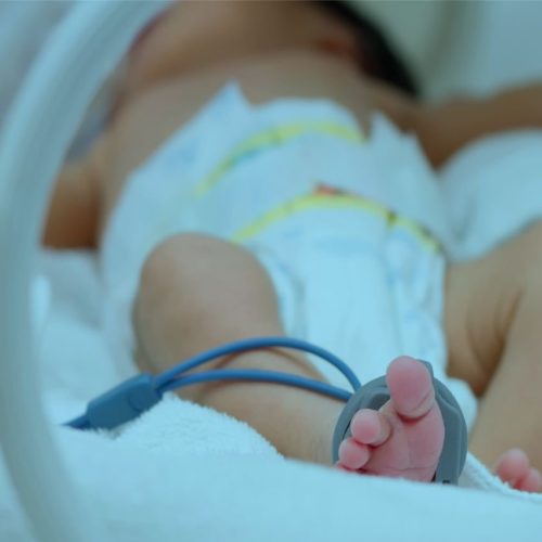 Bebê com Restrição de Crescimento Intra-Uterino (CIUR): fatos importantes que você precisa conhecer