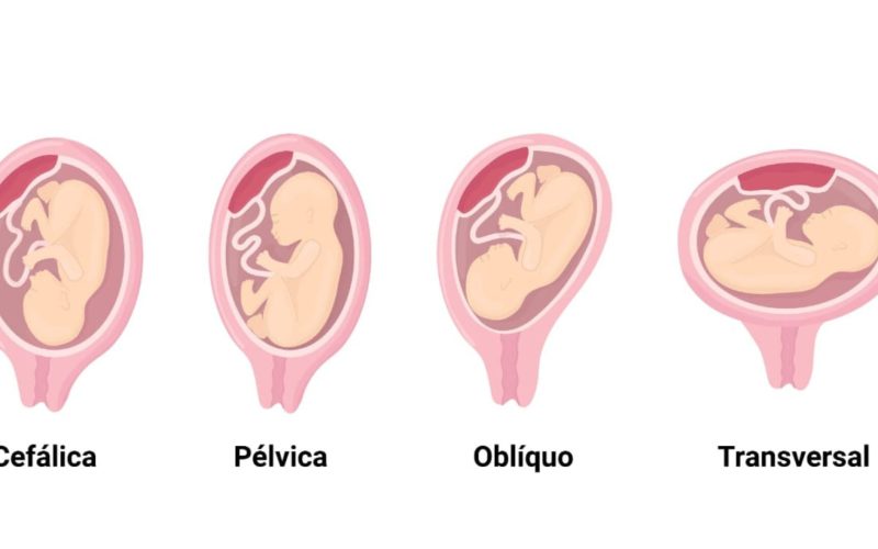 Posições Fetais
