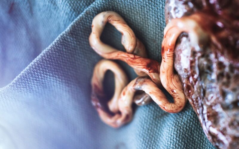 O Cordão Umbilical: Funções, Cuidados e Curiosidades