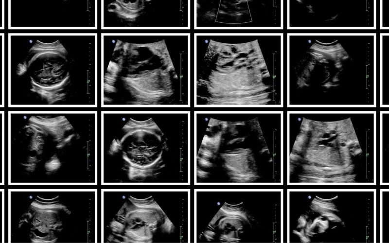 Desenvolvimento Fetal: O Que Esperar a Cada Trimestre