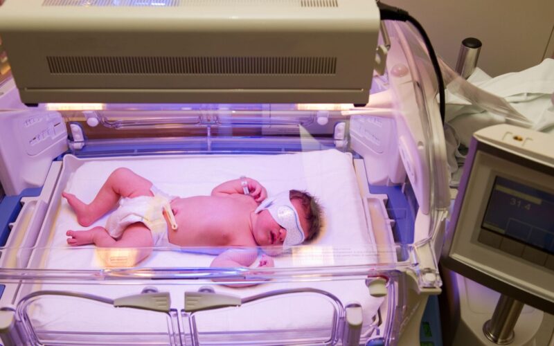 Icterícia Neonatal: Causas, Sintomas e Tratamento
