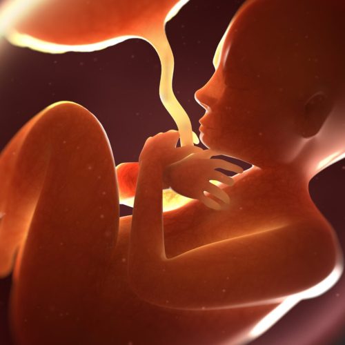 Polidrâmnio: Compreendendo Causas e Abordagens