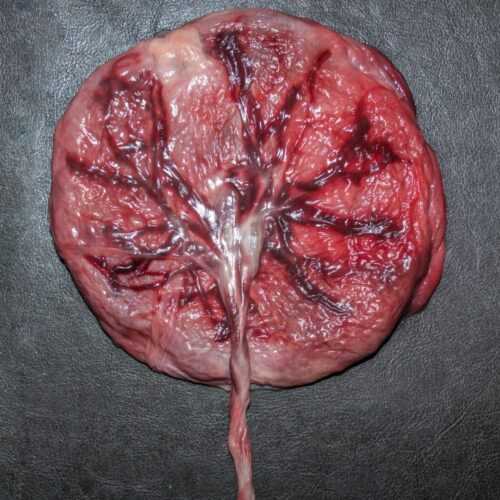 O Papel Vital da Placenta Durante a Gravidez: Conhecendo sua Importância e Funções