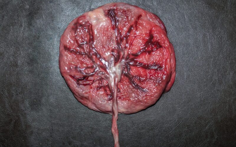 O Papel Vital da Placenta Durante a Gravidez: Conhecendo sua Importância e Funções
