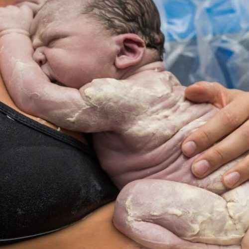 Vérnix: entenda o que é e qual a importância para o bebê