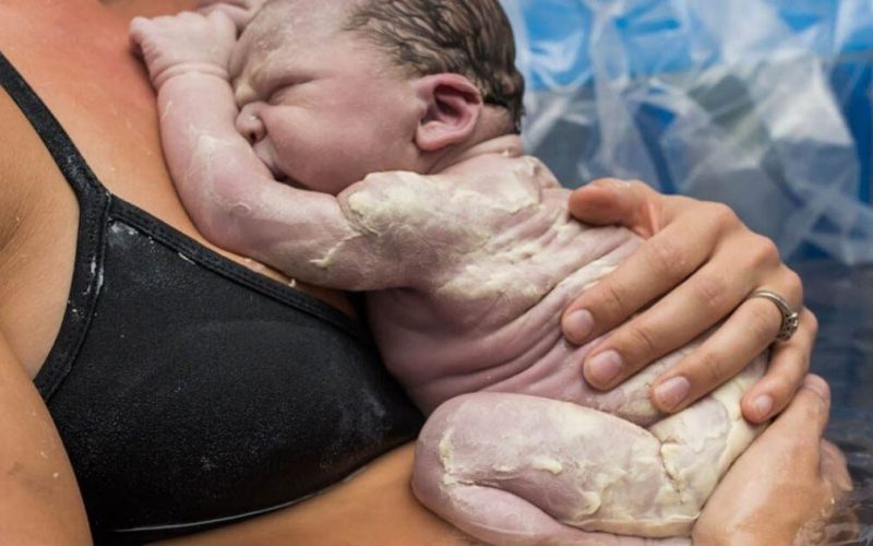 Vérnix: entenda o que é e qual a importância para o bebê