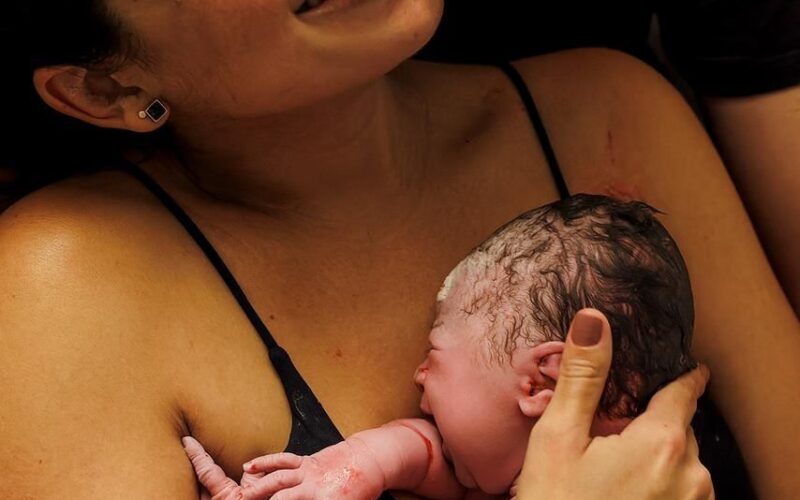 Como Aliviar as Cólicas no Bebê