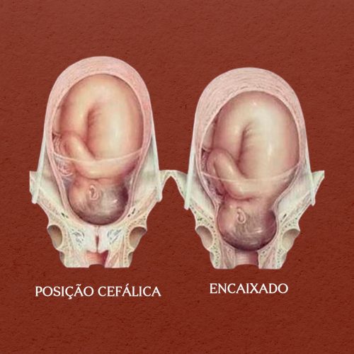 bebe encaixado blog
