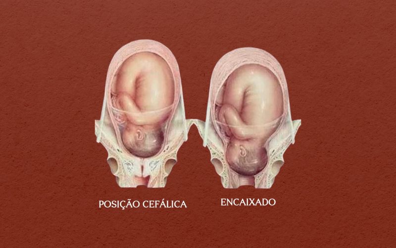 bebe encaixado blog