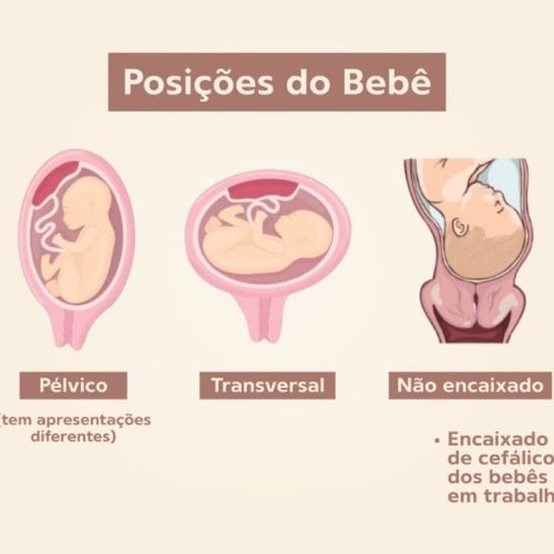 bebê não se encaixa